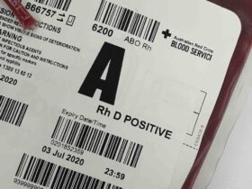 krew-podczas-porodu-ile-tracimy-i-kiedy-to-moze-byc-niebezpieczne