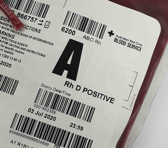 krew-podczas-porodu-ile-tracimy-i-kiedy-to-moze-byc-niebezpieczne